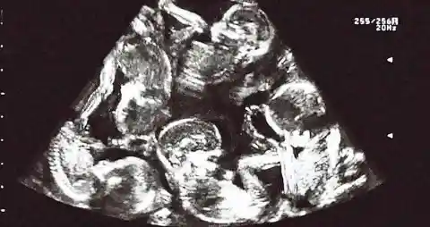 Other-Wordly Sonogram