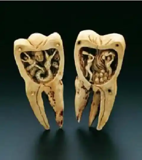 The Mythical Tooth Worm