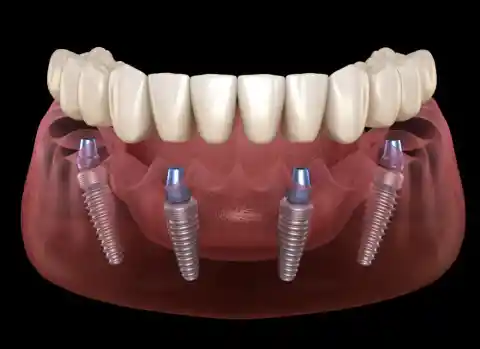 Dentures Were Made With Soldiers' Teeth